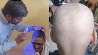ഒന്നു തൊട്ടാൽ മതി, മുടിയെല്ലാം കൊഴിഞ്ഞുവീഴുന്നു; നിരവധിപ്പേർക്ക് തലയിൽ ഒരു മുടി പോലുമില്ലാതായത് ഒരാഴ്ച കൊണ്ട്