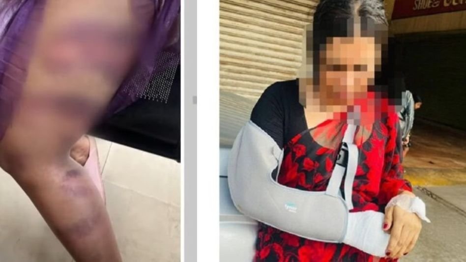 കൊച്ചിയിൽ ട്രാന്‍സ്‌ജെന്‍ഡറിനെ ഇരുമ്പ് വടികൊണ്ട് ക്രൂരമായി മര്‍ദിച്ചു: രണ്ടുപേർ പിടിയിൽ