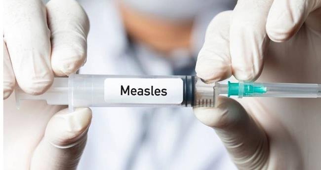 അ​ഞ്ചാം​പ​നി ബാ​ധി​ച്ച് ടെ​ക്സ​സി​ൽ കു​ട്ടി മ​രി​ച്ചു