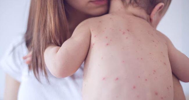 ടെ​ക്സ​സി​ൽ അ​ഞ്ചാം​പ​നി പ​ട​രു​ന്നു; ഇ​തു​വ​രെ പ​നി ബാ​ധി​ച്ച​ത് 683 പേ​ർ​ക്ക്