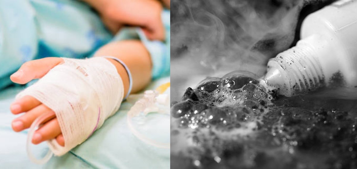 കളിച്ചുകൊണ്ടിരിക്കെ അബദ്ധത്തിൽ ആസിഡ് കുടിച്ചു; അഞ്ച് വയസുകാരൻ പൊള്ളലേറ്റ് ​ഗുരുതരാവസ്ഥയിൽ