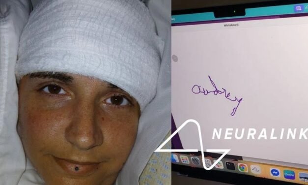 ശാസ്ത്രമുന്നേറ്റം! 20 വർഷമായി തളർന്നുകിടക്കുന്ന യുവതി ന്യൂറാലിങ്കിന്റെ സഹായത്താൽ സ്വന്തം പേരെഴുതി