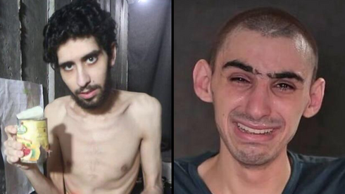 പട്ടിണി മൂലം ഹമാസ് ബന്ദികളാക്കിയവരുടെ മരണസാധ്യത ഏറുന്നതായി മെഡിക്കൽ റിപ്പോർട്ട്