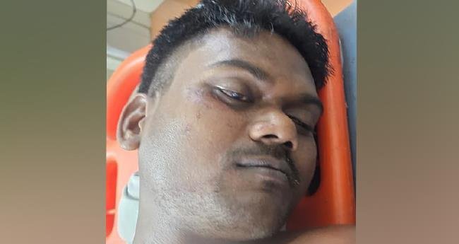 കോ​ഴി​ക്കോ​ട്ട് ഇ​ത​ര​സം​സ്ഥാ​ന തൊ​ഴി​ലാ​ളി കു​ത്തേ​റ്റു മ​രി​ച്ചു