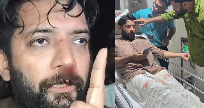 ഷാ​ഫി​ക്ക് മ​ർ​ദ​ന​മേ​റ്റ സം​ഭ​വം; ഡി​ജി​പി​ക്ക് പ​രാ​തി ന​ൽ​കി കോ​ൺ​ഗ്ര​സ്