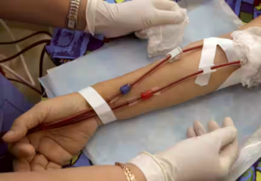 ഡയാലിസിസ് ധനസഹായം അനുവദിക്കാൻ സർക്കാർ ഡോക്ടർമാർക്ക് വിസമ്മതം: താക്കീതുമായി മനുഷ്യാവകാശ കമ്മീഷൻ