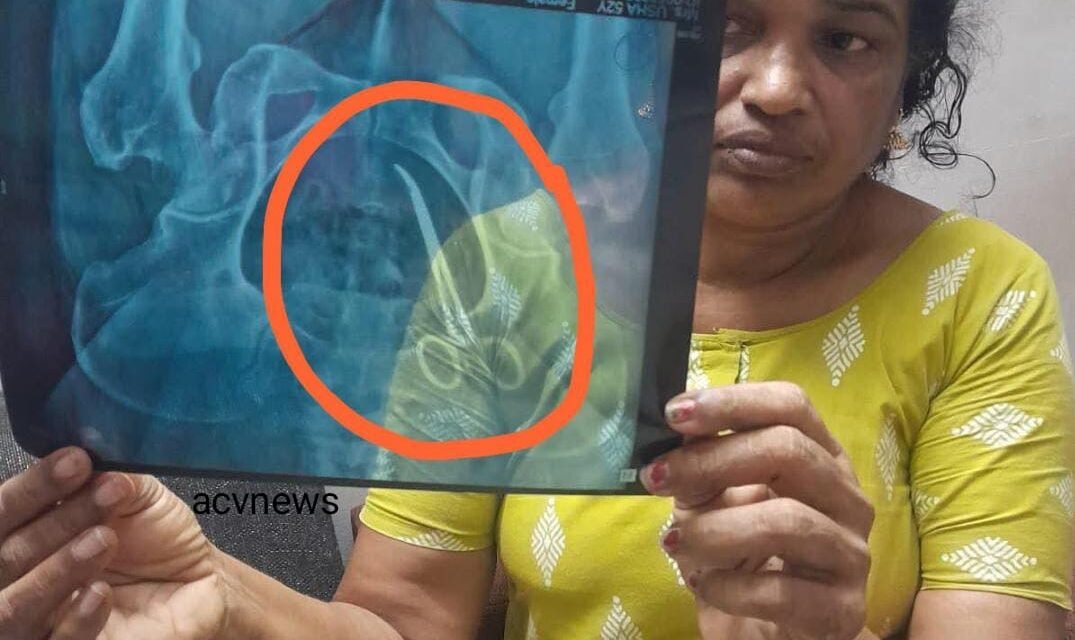 ഗുരുതര വീഴ്ചയുണ്ടായി; ആ വ്യക്തി അനുഭവിച്ച വേദനയ്ക്ക് ഒരു ന്യായീകരണവുമില്ല, നടപടിയുണ്ടാകും: മന്ത്രി വീണാ ജോർജ്