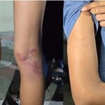 ന​മ്പ​ർ പ്ലേ​റ്റി​ന് കേ​ടു​പാ​ട് വ​രു​ത്തി; വി​ദ്യാ​ർ​ഥി​ക​ളെ​യും സ​ഹ​പ്ര​വ​ർ​ത്ത​ക​രെ​യും ക്രൂ​ര​മാ​യി മ​ർ​ദി​ച്ച് അ​ധ്യാ​പ​ക​ൻ