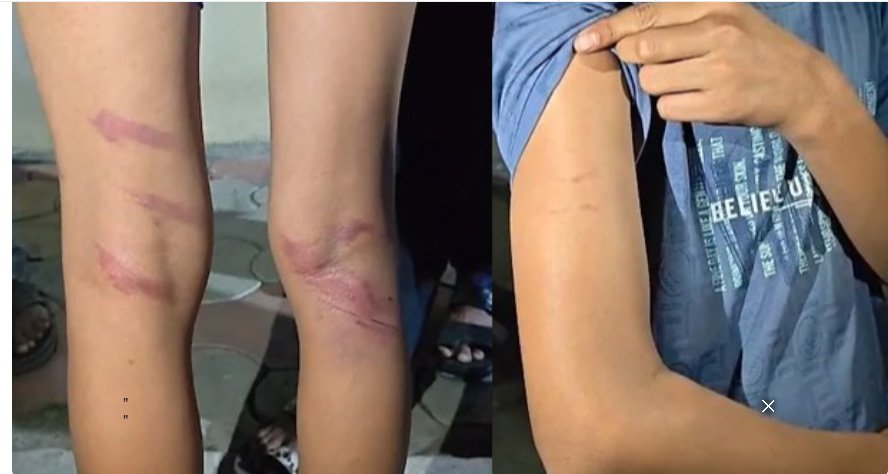 ന​മ്പ​ർ പ്ലേ​റ്റി​ന് കേ​ടു​പാ​ട് വ​രു​ത്തി; വി​ദ്യാ​ർ​ഥി​ക​ളെ​യും സ​ഹ​പ്ര​വ​ർ​ത്ത​ക​രെ​യും ക്രൂ​ര​മാ​യി മ​ർ​ദി​ച്ച് അ​ധ്യാ​പ​ക​ൻ