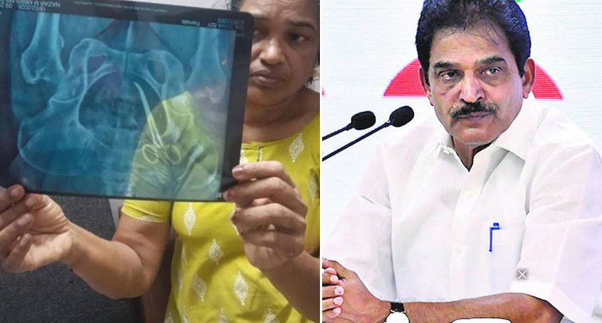 വയറ്റിൽ കത്രിക കുടുങ്ങിയ വീട്ടമ്മയ്ക്ക് തുണയായി കെ.സി; ഉഷയെ അമൃത ആശുപത്രിയിലേക്ക് മാറ്റി