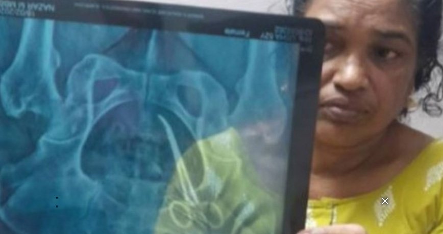 വ​യ​റ്റി​ൽ ക​ത്രി​ക ക​ണ്ടെ​ത്തി​യ സം​ഭ​വം; റി​പ്പോ​ർ​ട്ട് ഇ​ന്ന് കൈ​മാ​റും