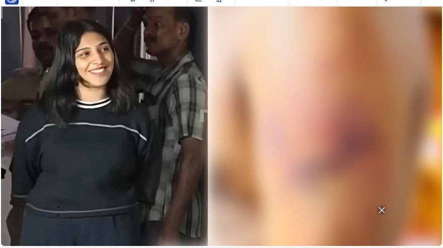 ഭിന്നശേഷിക്കാരനായ യുവാവിനെ മര്‍ദിച്ച സംഭവം: ഒളിവിലുള്ള പ്രതിക്കായി അന്വേഷണം