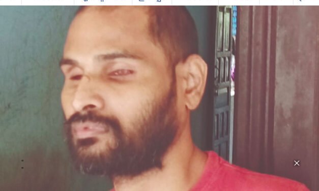 മുട്ടുവേ​​ദ​​​ന​​​യ്ക്കു ചി​​​കി​​​ത്സയ്ക്കെത്തി​​​; കണ്ണ് ചൂഴ്ന്നെടുത്തു