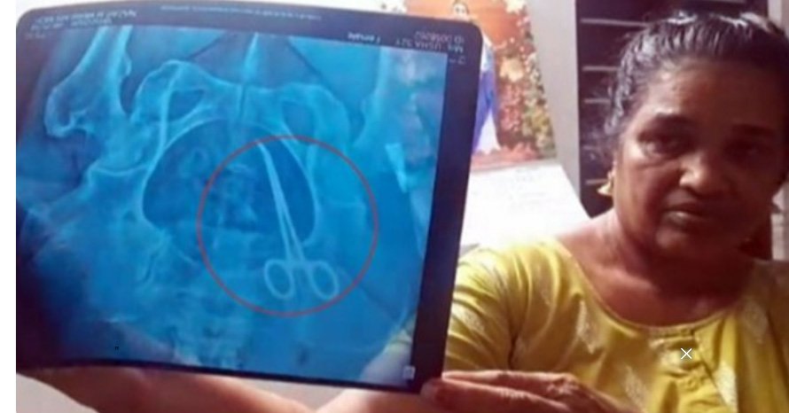 രോ​ഗി​യു​ടെ വ​യ​റ്റി​ൽ ക​ത്രി​ക കു​ടു​ങ്ങി​യ സം​ഭ​വം; ഡോ. ​ജെ. ഷാ​ഹി​ദ​യെ പ്ര​തി​ചേ​ർ​ക്കും