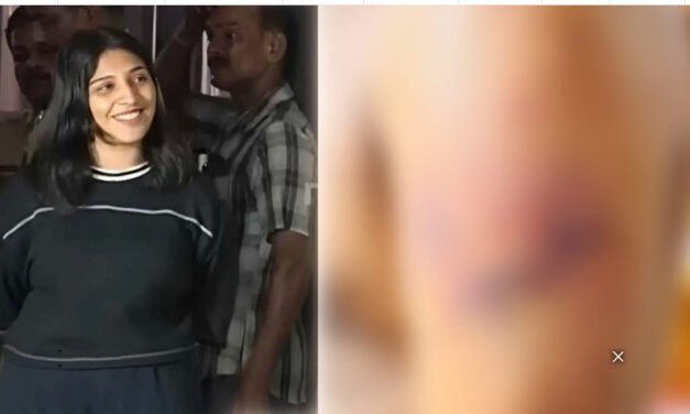 ഭി​ന്ന​ശേ​ഷി​ക്കാ​ര​ന് ഹ​ണി​ട്രാ​പ്പ് സം​ഘ​ത്തി​ന്‍റെ ക്രൂ​ര​മ​ര്‍​ദ​നം: പ്ര​തി​ക​ളെ ഉ​ട​ന്‍ ക​സ്റ്റ​ഡി​യി​ല്‍ വാ​ങ്ങും