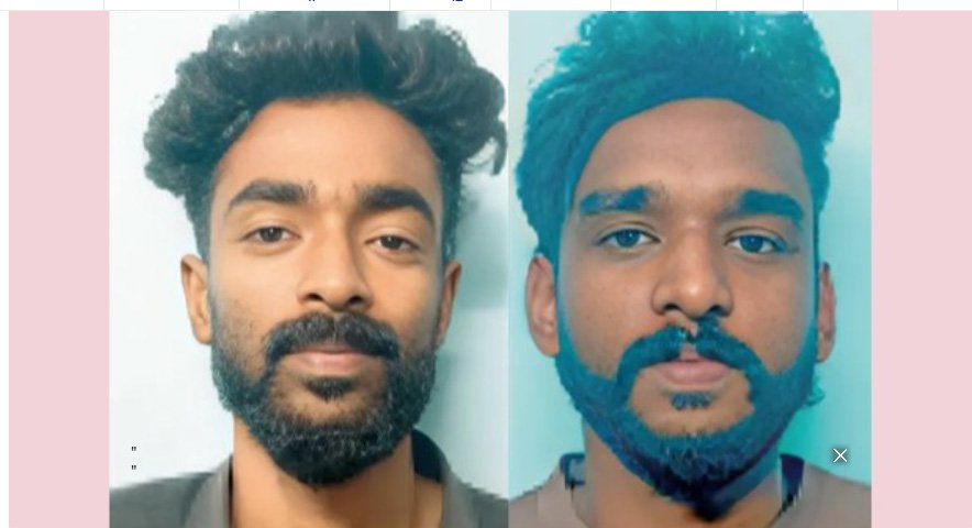 കൂ​ലി ചോ​ദി​ച്ച ബാ​ർ​ബ​റു​ടെ കൈ ​ത​ല്ലി​യൊ​ടി​ച്ചു; പ്ര​തി​ക​ൾ പി​ടി​യി​ൽ