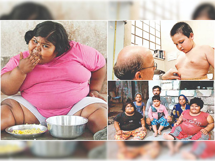 ലോകത്ത് പൊണ്ണത്തടിയുള്ള കുട്ടികളുടെയും കൗമാരക്കാരുടെയും എണ്ണം പത്തൊൻപത് കോടിയോളം: യൂണിസെഫ്