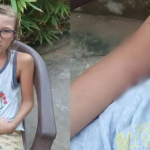 കോവളം ബീച്ചിൽ റഷ്യൻ ബാലന്‌ തെരുവ് നായയുടെ കടിയേറ്റു