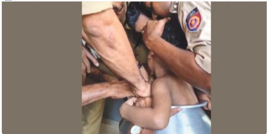 ക​ല​ത്തി​ൽ കു​ടു​ങ്ങി​യ കു​ട്ടി​യെ ര​ക്ഷ​പ്പെ​ടു​ത്തി