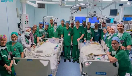 18.5 മണിക്കൂർ നീണ്ട ശസ്ത്രക്രിയ; ഒട്ടിച്ചേർന്നിരുന്ന ഫിലിപ്പിനോ ഇരട്ടകളെ വേർപെടുത്തി സൗദി സർജന്മാർ