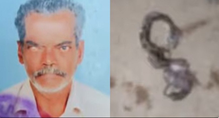 പാ​മ്പ് ക​ടി​യേ​റ്റ് ചി​കി​ത്സി​ൽ ക​ഴി​ഞ്ഞ കാ​ഴ്ച പ​രി​മി​തി​യു​ള്ള​യാ​ൾ മ​രി​ച്ചു